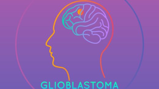 types,-symptoms,-causes,-treatment,-and-diagnosis-of-glioblastoma